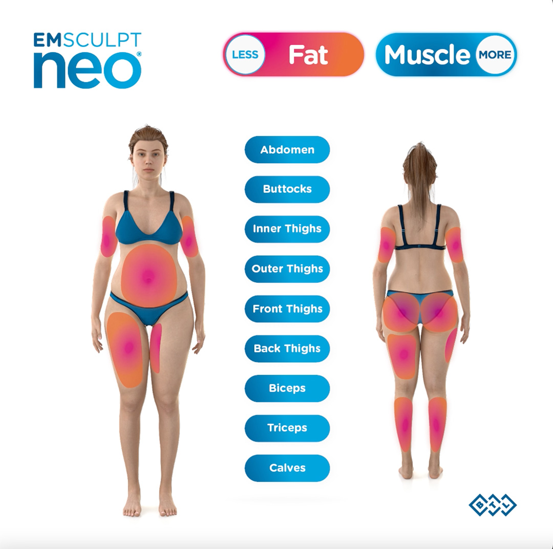 EMSCULPT NEO for Body Sculpting - Woman To Woman Magazine